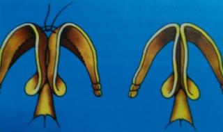 缩小鼻头手术多少钱